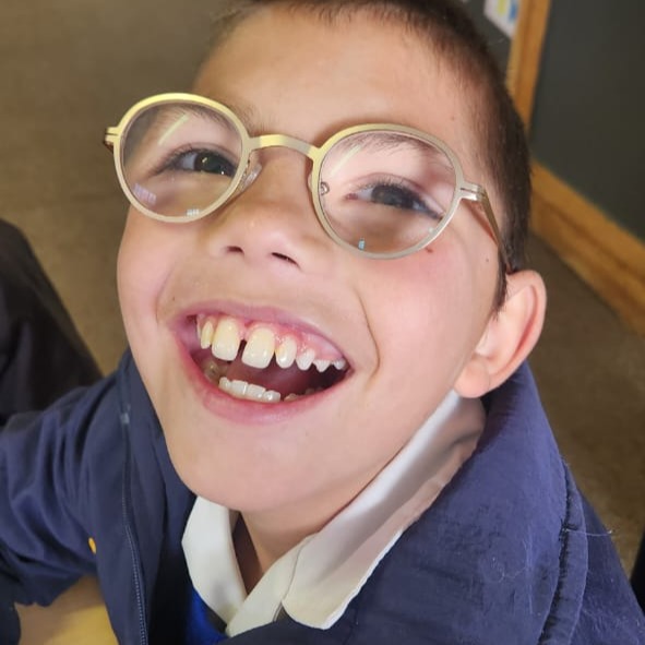 “Scherp zicht, grote dromen.”

Deze jongeman is leerling op de Maluti Hooglandskool in Bethlehem Zuid-Afrika. En hij had een bril nodig omdat hij zeer slechte ogen heeft, bij de oogmeting kwam met op een strekte van +8. 

Met een brilsterkte van +8 ben je sterk verziend. Zonder bril is dichtbij zien vaak erg wazig, en ook in de verte blijft het beeld meestal onscherp. 

Lezen lukt nauwelijks zonder bril en een boek moet ver weg worden gehouden om nog iets te kunnen onderscheiden. Dit kan leiden tot vermoeide ogen, hoofdpijn en moeite met scherpstellen. Alles lijkt soms mistig, en bij kinderen kan het zelfs scheelzien veroorzaken doordat de ogen voortdurend hard moeten werken om te focussen.

Wanneer iemand voor het eerst een goede bril krijgt, kan dat een bijzonder moment zijn. Plots worden kleuren helderder, gezichten duidelijker en details zichtbaar: bladeren aan bomen, letters op een bord, de wereld komt tot leven.

Een bril lijkt misschien iets kleins, maar voor een kind kan het een groot verschil maken. Het kan betekenen dat leren weer lukt, dat zelfvertrouwen groeit en talenten zich kunnen ontwikkelen. Onderwijs verandert van een worsteling in een kans.

Zo geeft een bril niet alleen scherp zicht, maar ook perspectief. Het opent de deur naar kennis, dromen en een toekomst met mogelijkheden. Soms begint een nieuw leven simpelweg met het kunnen zien van wat er op het schoolbord staat.

“Scherp zicht, grote dromen.”💪